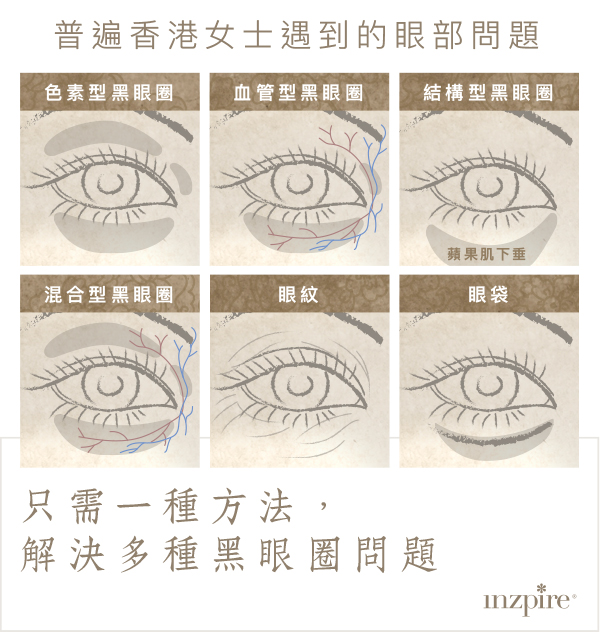 Inzpire經絡磁療活眼經療法 常見眼部問題 去眼袋 去黑眼圈